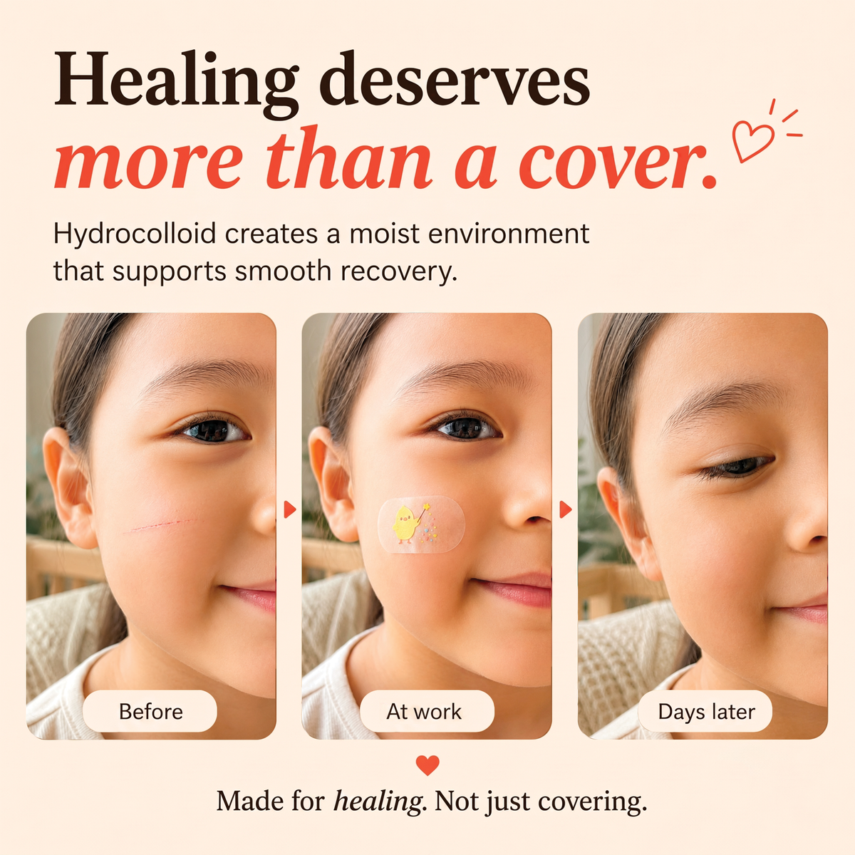 MoistureBand Hydrocolloid Bandages for Kids (35 Count)