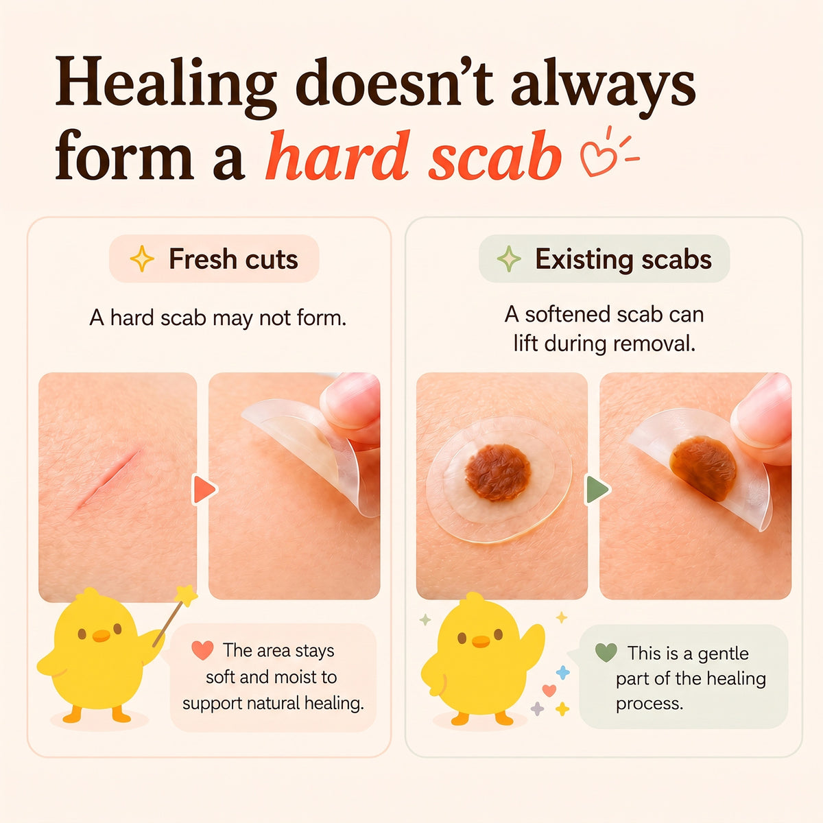MoistureBand Hydrocolloid Bandages for Kids (35 Count)