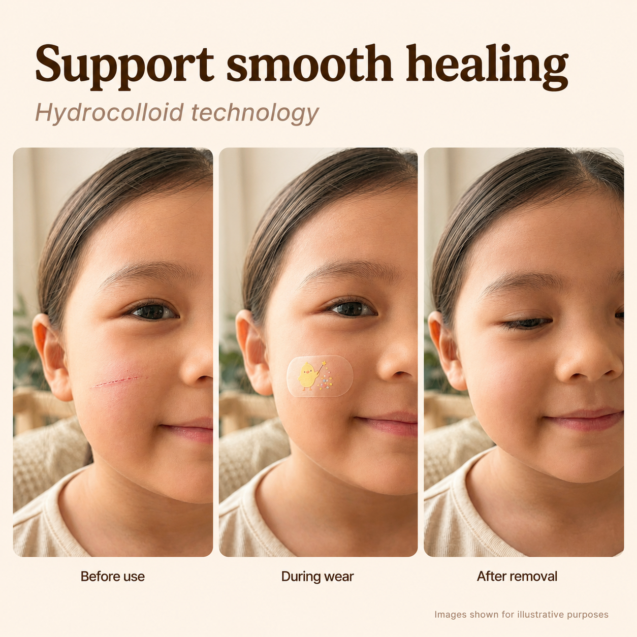 MoistureBand Hydrocolloid Bandages for Kids (35 Count)